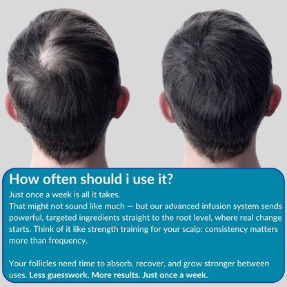 Infusion Hair Regrowth Kit