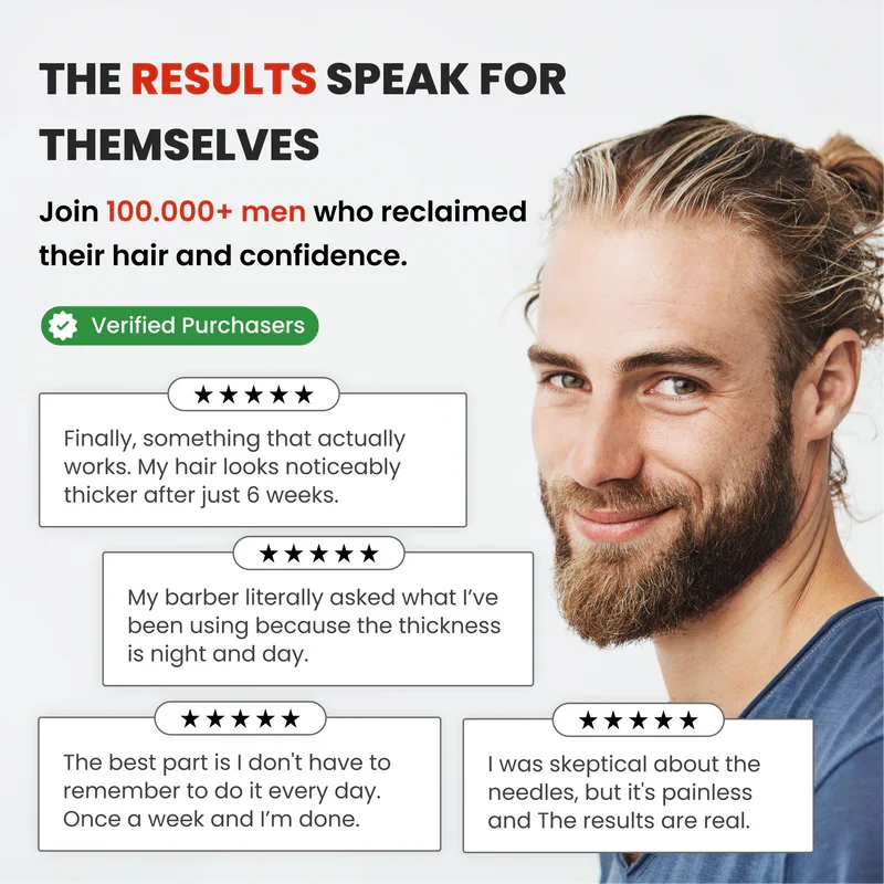 AlphaInfuse Hair Regrowth System