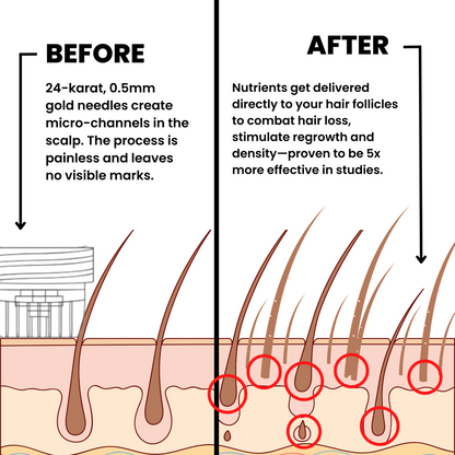 AlphaInfuse Hair Regrowth System